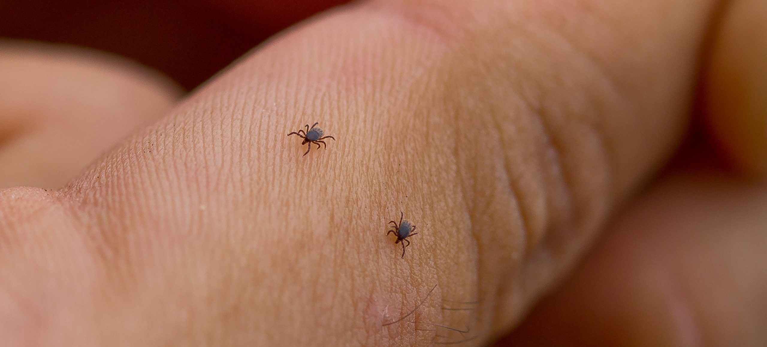 קדחת הבהרות